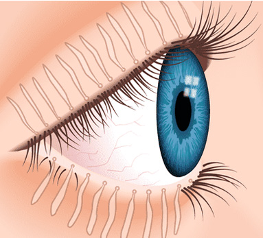 Dry Eye Definition & Diagnosis Explained | MyDryEye.ca