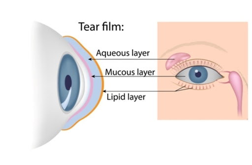 Diagram showing the three layers of the tear film on top of a cornea