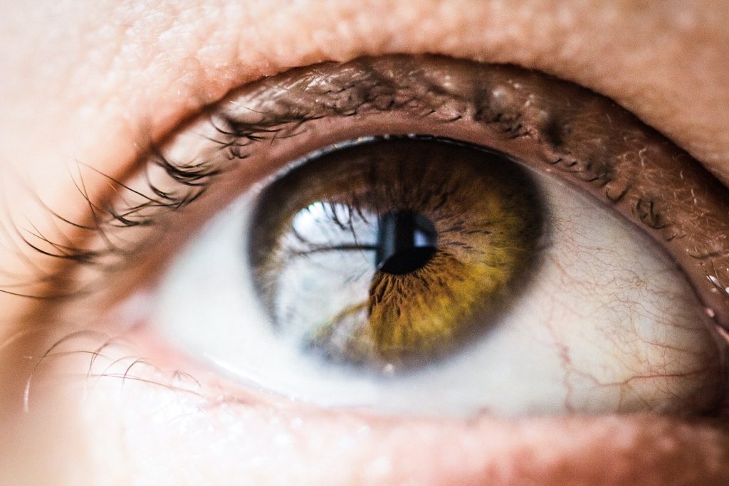 Lumenis Optimal Intense Pulsed Light for Chronic Dry Eye
