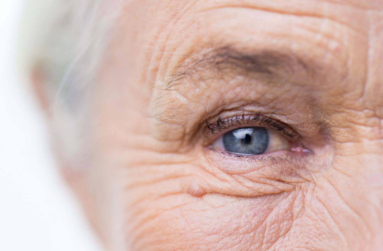 Can Dry Eye Disease Cause Floaters & Flashes? MyDryEye.ca