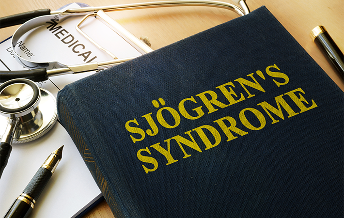 Black book with the title "Sjögren’s Syndrome" in gold letters. It sits on top of medical papers and tool on a wooden desk.