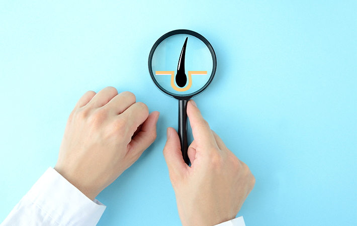 An illustration of a close up of a hair finical is being examined by a magnifying glass. Ther is a pair of hand, one is holding the tool. The background is a light blue.