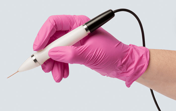 A hand wearing a pink sterile glove holds the Jett Plasma Pen, which resembles a large marker with a cord on the end.